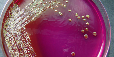 Curso teórico on-line de métodos de análise microbiológica de alimentos 
