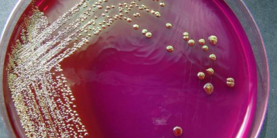 Curso teórico on-line de métodos de análise microbiológica de alimentos – 5 módulos